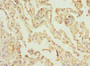 Immunohistochemistry of paraffin-embedded human lung tissue using CAC10753 at dilution of 1:100