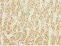 Immunohistochemistry of paraffin-embedded human adrenal gland tissue using CAC10760 at dilution of 1:100