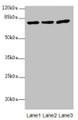 Western blot; All lanes: KBTBD7 antibody at 1.85µg/ml; Lane 1: HL60 whole cell lysate; Lane 2: A549 whole cell lysate; Lane 3: 293T whole cell lysate; Secondary; Goat polyclonal to rabbit IgG at 1/10000 dilution; Predicted band size: 77 kDa; Observed band size: 77 kDa;