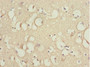 Immunohistochemistry of paraffin-embedded human brain tissue using CAC10766 at dilution of 1:100