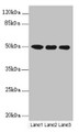 Western blot; All lanes: MOCS3 antibody at 4.25µg/ml; Lane 1: A549 whole cell lysate; Lane 2: HepG2 whole cell lysate; Lane 3: Jurkat whole cell lysate; Secondary; Goat polyclonal to rabbit IgG at 1/10000 dilution; Predicted band size: 50 kDa; Observed band size: 50 kDa;