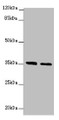 Western blot; All lanes: OSGEP antibody at 2.04µg/ml; Lane 1: Jurkat whole cell lysate; Lane 2: PC-3 whole cell lysate; Secondary; Goat polyclonal to rabbit IgG at 1/10000 dilution; Predicted band size: 36 kDa; Observed band size: 36 kDa Western blot; All lanes: OSGEP antibody at 2.04µg/ml; Lane 1: Jurkat whole cell lysate; Lane 2: PC-3 whole cell lysate; Secondary; Goat polyclonal to rabbit IgG at 1/10000 dilution; Predicted band size: 36 kDa; Observed band size: 36 kDa