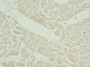 Immunohistochemistry of paraffin-embedded human heart tissue using CAC10768 at dilution of 1:100 Immunohistochemistry of paraffin-embedded human heart tissue using CAC10768 at dilution of 1:100