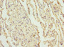 Immunohistochemistry of paraffin-embedded human lung tissue using CAC10770 at dilution of 1:100