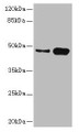 Western blot; All lanes: CSNK1G2 antibody at 4.21µg/ml; Lane 1: Mouse gonadal tissue; Lane 2: Hela whole cell lysate; Secondary; Goat polyclonal to rabbit IgG at 1/10000 dilution; Predicted band size: 47 kDa; Observed band size: 47 kDa;
