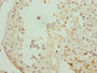 Immunohistochemistry of paraffin-embedded human testis tissue using CAC10773 at dilution of 1:100