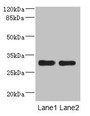 Western blot; All lanes: DRAM2 antibody at 3.84µg/ml; Lane 1: Mouse heart tissue; Lane 2: Mouse liver tissue; Secondary; Goat polyclonal to rabbit IgG at 1/10000 dilution; Predicted band size: 30 kDa; Observed band size: 30 kDa;