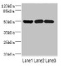 Western blot; All lanes: IFRD1 antibody at 1.76µg/ml; Lane 1: Mouse skeletal muscle tissue; Lane 2: Hela whole cell lysate; Lane 3: Jurkat whole cell lysate; Secondary; Goat polyclonal to rabbit IgG at 1/10000 dilution; Predicted band size: 51, 46 kDa; Observed band size: 51 kDa;