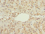 Immunohistochemistry of paraffin-embedded human adrenal gland tissue using CAC10785 at dilution of 1:100