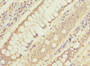 Immunohistochemistry of paraffin-embedded human colon cancer using CAC10786 at dilution of 1:100