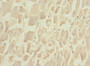 Immunohistochemistry of paraffin-embedded human heart tissue using CAC10787 at dilution of 1:100