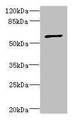 Western blot; All lanes: TBCE antibody at 5.55µg/ml + CEM whole cell lysate; Secondary; Goat polyclonal to rabbit IgG at 1/10000 dilution; Predicted band size: 60, 65 kDa; Observed band size: 60 kDa