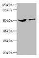 Western blot; All lanes: CPN1 antibody at 6.19µg/ml; Lane 1: Mouse liver tissue; Lane 2: MCF-7 whole cell lysate; Secondary; Goat polyclonal to rabbit IgG at 1/10000 dilution; Predicted band size: 52 kDa; Observed band size: 52 kDa