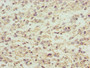 Immunohistochemistry of paraffin-embedded human glioma using CAC10790 at dilution of 1:100