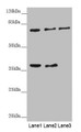 Western blot; All lanes: GAS2L1 antibody at 0.71µg/ml; Lane 1: A431 whole cell lysate; Lane 2: Hela whole cell lysate; Lane 3: 293T whole cell lysate; Secondary; Goat polyclonal to rabbit IgG at 1/10000 dilution; Predicted band size: 73, 37, 35, 49 kDa; Observed band size: 73, 37 kDa