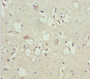 Immunohistochemistry of paraffin-embedded human brain tissue using CAC10792 at dilution of 1:100