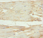 Immunohistochemistry of paraffin-embedded human skeletal muscle tissue using CAC10796 at dilution of 1:100