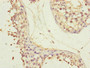 Immunohistochemistry of paraffin-embedded human testis tissue using CAC10813 at dilution of 1:100