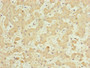 Immunohistochemistry of paraffin-embedded human liver tissue using CAC10816 at dilution of 1:100