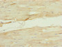 Immunohistochemistry of paraffin-embedded human skeletal muscle tissue using CAC10816 at dilution of 1:100