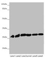 Western blot; All lanes: PGLS antibody at 4.19µg/ml; Lane 1: Mouse liver tissue; Lane 2: Mouse brain tissue; Lane 3: U251 whole cell lysate; Lane 4: THP-1 whole cell lysate; Lane 5: HepG2 whole cell lysate; Lane 6: Hela whole cell lysate; Secondary; Goat polyclonal to rabbit IgG at 1/10000 dilution; Predicted band size: 28 kDa; Observed band size: 28 kDa Western blot; All lanes: PGLS antibody at 4.19µg/ml; Lane 1: Mouse liver tissue; Lane 2: Mouse brain tissue; Lane 3: U251 whole cell lysate; Lane 4: THP-1 whole cell lysate; Lane 5: HepG2 whole cell lysate; Lane 6: Hela whole cell lysate; Secondary; Goat polyclonal to rabbit IgG at 1/10000 dilution; Predicted band size: 28 kDa; Observed band size: 28 kDa