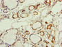 Immunohistochemistry of paraffin-embedded human thyroid tissue using CAC10818 at dilution of 1:100 Immunohistochemistry of paraffin-embedded human thyroid tissue using CAC10818 at dilution of 1:100