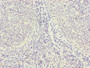 Immunohistochemistry of paraffin-embedded human tonsil tissue using CAC10818 at dilution of 1:100 Immunohistochemistry of paraffin-embedded human tonsil tissue using CAC10818 at dilution of 1:100