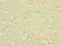 Immunohistochemistry of paraffin-embedded human brain tissue using CAC10823 at dilution of 1:100