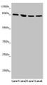 Western blot; All lanes: MFN1 antibody at 1.1µg/ml; Lane 1: Human placenta tissue; Lane 2: Jurkat whole cell lysate; Lane 3: Hela whole cell lysate; Lane 4: K562 whole cell lysate; Secondary; Goat polyclonal to rabbit IgG at 1/10000 dilution; Predicted band size: 85, 42, 72 kDa; Observed band size: 85 kDa;