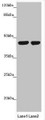 Western blot; All lanes: MTERFD3 antibody at 1.66 µg/ml; Lane 1: U251 whole cell lysate; Lane 2: HepG2 whole cell lysate; Secondary; Goat polyclonal to rabbit IgG at 1/10000 dilution; Predicted band size: 44 kDa; Observed band size: 44 kDa;