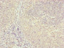 Immunohistochemistry of paraffin-embedded human tonsil tissue using CAC10832 at dilution of 1:100