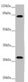 Western blot; All lanes: MID2 antibody at 3.32 µg/ml + Mouse small intestine tissue; Secondary; Goat polyclonal to rabbit IgG at 1/10000 dilution; Predicted band size: 84, 80 kDa; Observed band size: 84, 30 kDa;