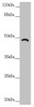Western blot; All lanes: TRIM31 antibody at 6.18µg/ml + A549 whole cell lysate; Secondary; Goat polyclonal to rabbit IgG at 1/10000 dilution; Predicted band size: 49, 31 kDa; Observed band size: 49 kDa