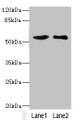 Western blot; All lanes: SLC30A1 antibody at 3.75µg/ml; Lane 1: A549 whole cell lysate; Lane 2: HepG2 whole cell lysate; Secondary; Goat polyclonal to rabbit IgG at 1/10000 dilution; Predicted band size: 55 kDa; Observed band size: 55 kDa;