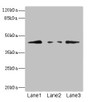 Western blot; All lanes: FBXO4 antibody at 3.1µg/ml; Lane 1: 293T whole cell lysate; Lane 2: HepG2 whole cell lysate; Lane 3: HL60 whole cell lysate; Secondary; Goat polyclonal to rabbit IgG at 1/10000 dilution; Predicted band size: 45, 36 kDa; Observed band size: 45 kDa