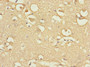Immunohistochemistry of paraffin-embedded human brain tissue using CAC10844 at dilution of 1:100