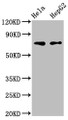 Western Blot; , Positive WB detected in: Hela whole cell lysate, HepG2 whole cell lysate; , All lanes: FRMD6 antibody at 3µg/ml; , Secondary; , Goat polyclonal to rabbit IgG at 1/50000 dilution; , Predicted band size: 73, 71, 30 kDa; , Observed band size: 73 kDa