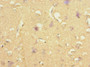 Immunohistochemistry of paraffin-embedded human brain tissue using CAC10854 at dilution of 1:100
