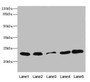 Western blot; All lanes: TIMM23 antibody at 3.03µg/ml; Lane 1: Rat heart tissue; Lane 2: Mouse liver tissue; Lane 3: A431 whole cell lysate; Lane 4: MCF-7 whole cell lysate; Lane 5: Jurkat whole cell lysate; Secondary; Goat polyclonal to rabbit IgG at 1/10000 dilution; Predicted band size: 22 kDa; Observed band size: 22 kDa