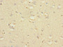 Immunohistochemistry of paraffin-embedded human brain tissue using CAC10861 at dilution of 1:100