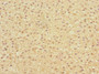 Immunohistochemistry of paraffin-embedded human adrenal gland tissue using CAC10865 at dilution of 1:100