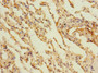 Immunohistochemistry of paraffin-embedded human lung tissue using CAC10867 at dilution of 1:100 Immunohistochemistry of paraffin-embedded human lung tissue using CAC10867 at dilution of 1:100