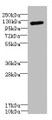Western blot; All lanes: ITGAXantibody IgG at 1.59µg/ml + Mouse kidney tissue; Secondary; Goat polyclonal to rabbit IgG at 1/10000 dilution; Predicted band size: 128 kDa; Observed band size: 128 kDa;