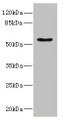Western blot; All lanes: CALCRantibody IgG at 5.24µg/ml + Rat heart tissue; Secondary; Goat polyclonal to rabbit IgG at 1/10000 dilution; Predicted band size: 60, 56, 50, 52, 35, 33 kDa; Observed band size: 60 kDa;