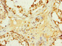 Immunohistochemistry of paraffin-embedded human testis tissue using CAC10879 at dilution of 1:100