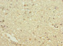 Immunohistochemistry of paraffin-embedded human brain tissue using CAC10879 at dilution of 1:100