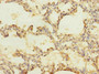 Immunohistochemistry of paraffin-embedded human lung tissue using CAC10883 at dilution of 1:100