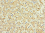 Immunohistochemistry of paraffin-embedded human liver tissue using CAC10891 at dilution of 1:100