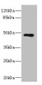 Western blot; All lanes: KIR3DL3 antibody at 1.75µg/ml + Jurkat whole cell lysate; Secondary; Goat polyclonal to rabbit IgG at 1/10000 dilution; Predicted band size: 45 kDa; Observed band size: 45 kDa