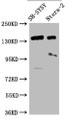 Western Blot; Positive WB detected in: SH-SY5Y whole cell lysate, Ntera-2 whole cell lysate; All lanes: ROBO2 antibody at 1:2000; Secondary; Goat polyclonal to rabbit IgG at 1/50000 dilution; Predicted band size: 131, 152, 154 kDa; Observed band size: 152 kDa;